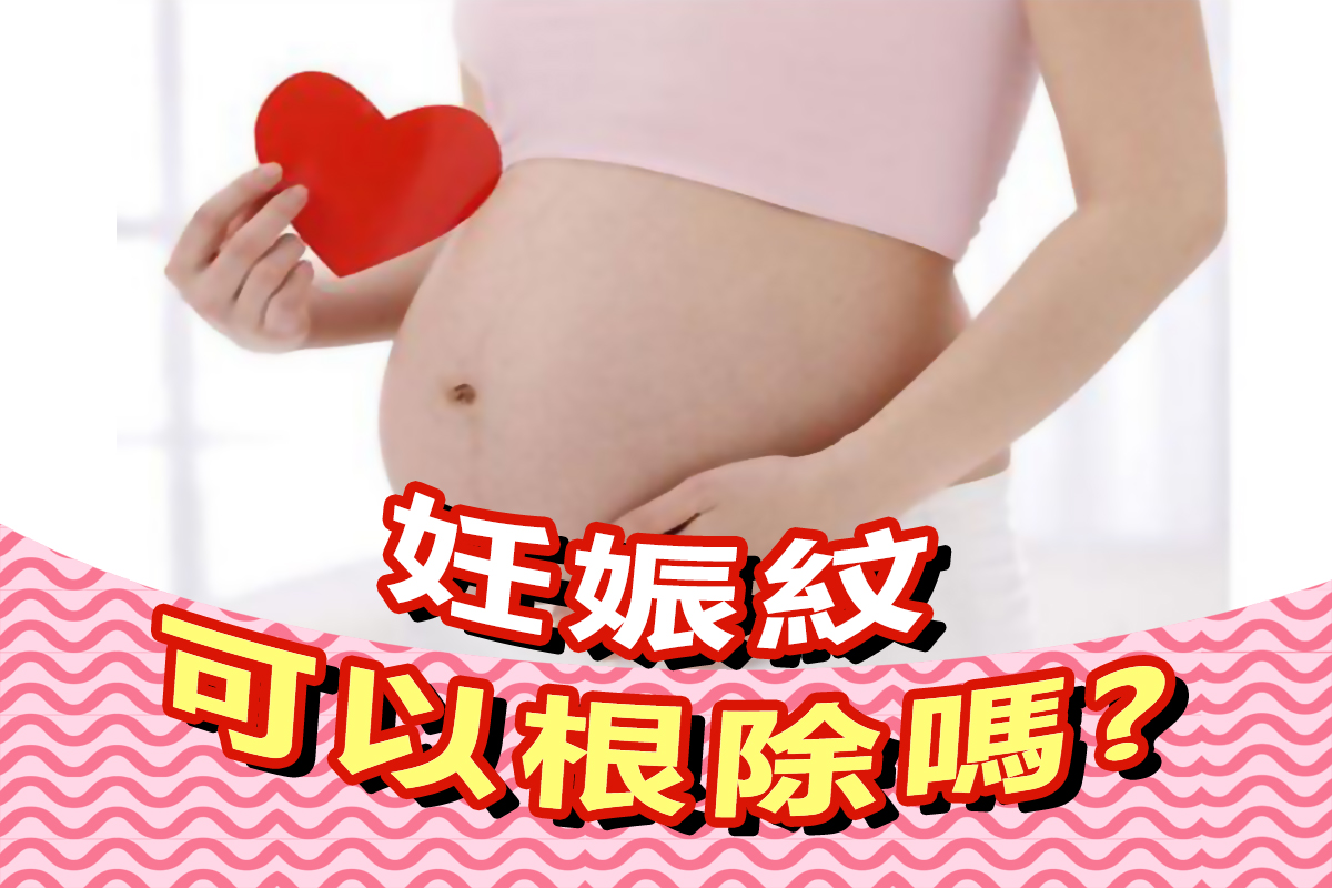 Vanicream薇霓肌本危肌百科｜肌管局｜保養迷思｜妊娠紋可以根除嗎,肥胖紋,懷孕婦,保濕乳霜