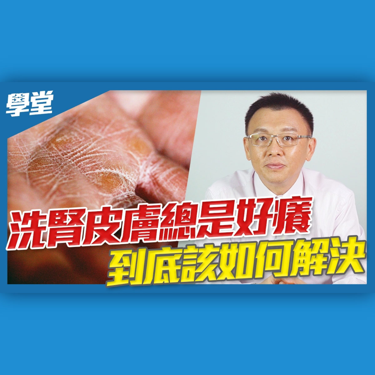 vanicream朱總經理來談洗腎皮膚癢該如何解決，詳情請看影片