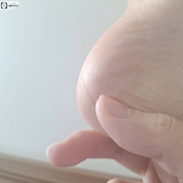 半半將薇霓肌本全日高效修護保濕乳霜抹在腳後跟的肌膚上吸收後的特寫照