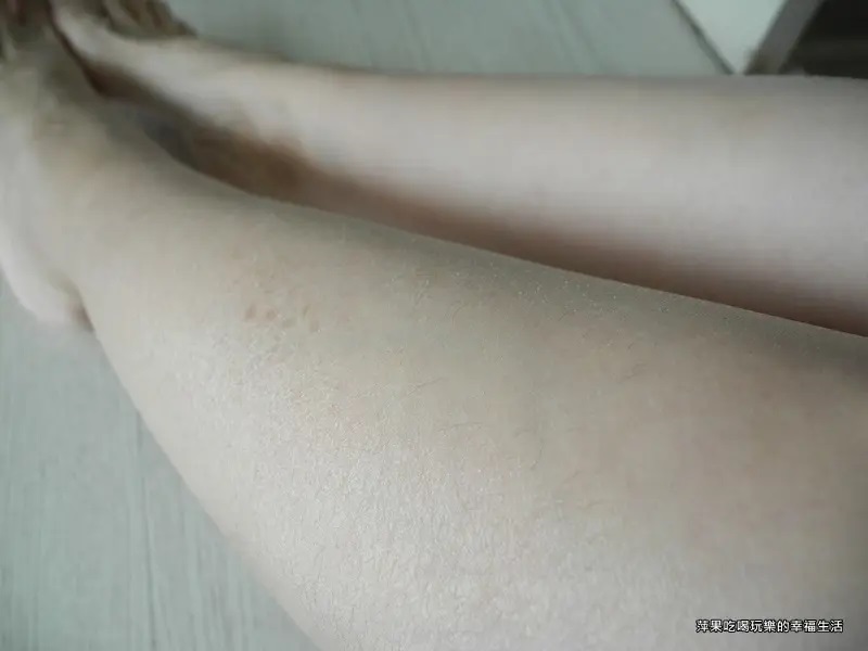 這張照片主要展示了腿部皮膚的細節，可能用於展示皮膚乾燥或敏感的狀態。照片風格特寫，呈現出皮膚的紋理和狀況。
