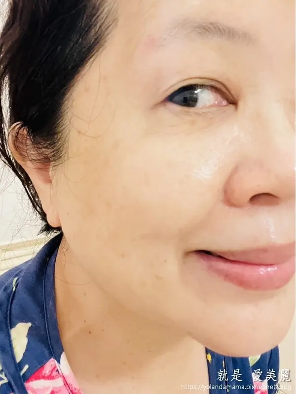 這張照片展示了一位中年女性使用VANICREAM薇霓肌本無油安膚清爽調理乳液旅行瓶後的臉部肌膚狀態。