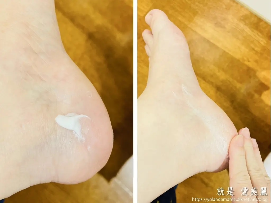 這兩張並列的圖片清晰地展示了一款乳霜產品在乾燥腳後跟上的使用效果。從塗抹前的乾燥脫皮到塗抹後的滋潤，強調了產品的保濕和修護作用。