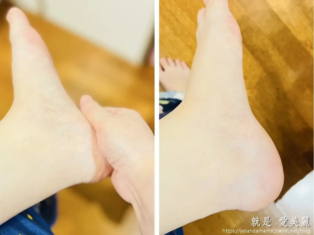 這兩張並列的圖片清晰地展示了腳部肌膚在護理前後的差異。從護理前的乾燥暗沉到護理後的光滑透亮，強調了所使用產品的保濕和改善膚質的效果。