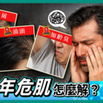 中年男性面露困擾神情，背景突顯三大肌膚困擾：「皮屑」、「油頭」、「加齡臭」示意圖，表現中年男性常見的肌膚與頭皮問題。整體視覺強調「中年危肌」議題，營造警示感與急需改善的氛圍，適合搭配保養品推薦、男性護理產品導購或醫學知識文章使用。