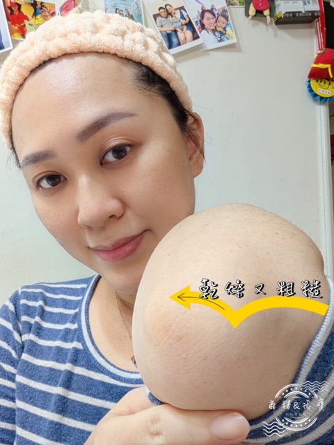 女性展示手肘肌膚乾燥粗糙部位，搭配箭頭與文字標示問題處，表情自然，背景為居家牆面與相片牆