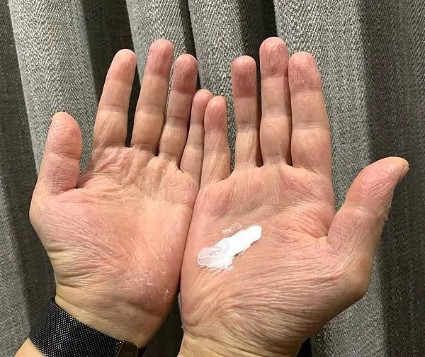 雙手掌心乾燥粗糙，右掌中央擠有薇霓肌本全日高效修護保濕乳霜，準備塗抹使用，呈現實際保養過程