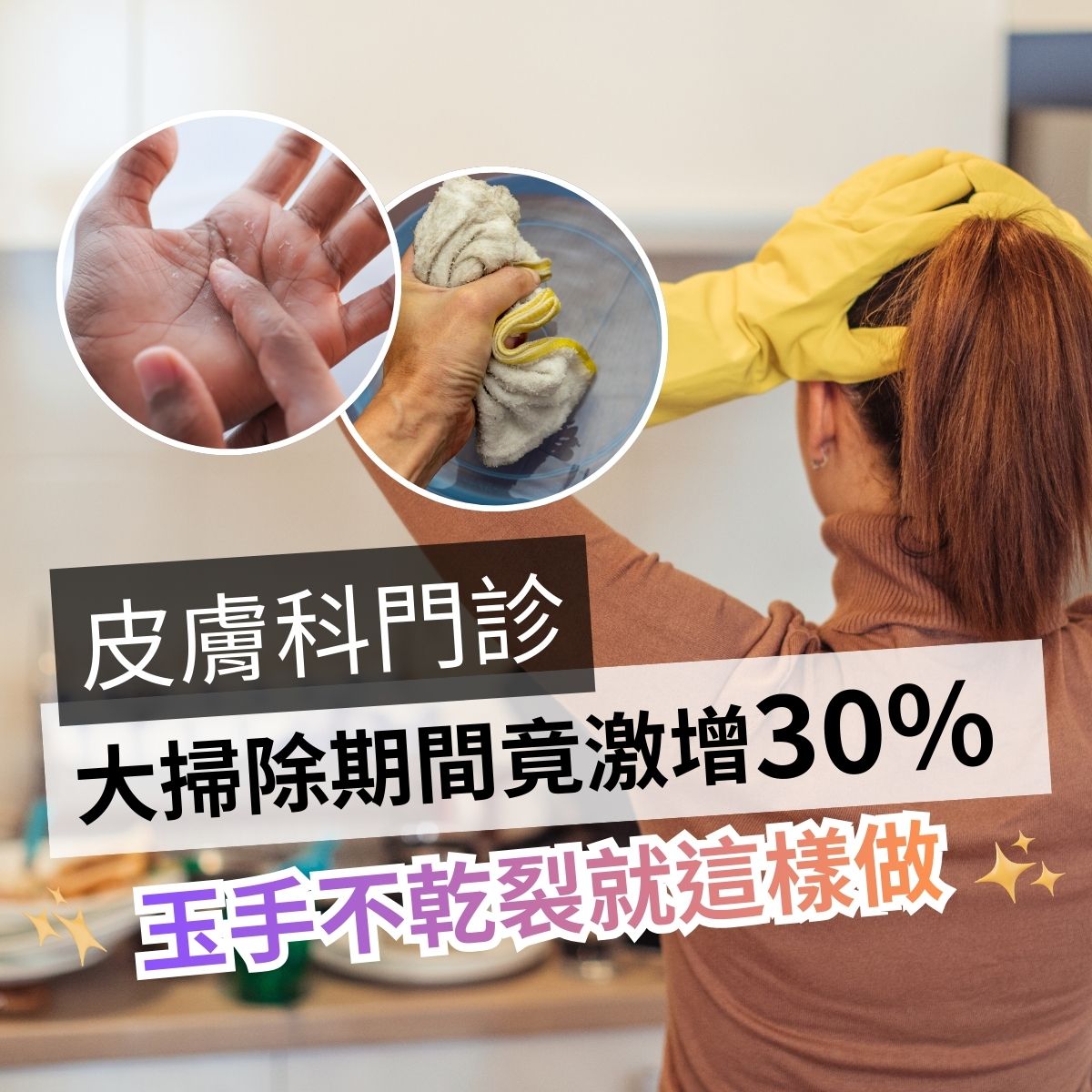 清潔家務時的手部使用情境，呈現長時間接觸水與清潔用品可能帶來的肌膚乾燥感受。