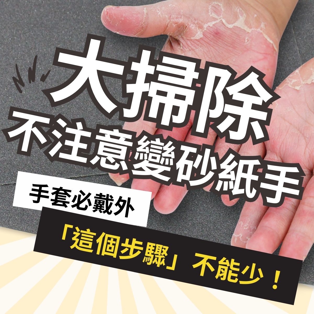 雙手手掌近距離畫面，可見手部皮膚乾燥脫屑的外觀狀態。