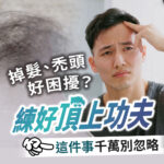 男性掉髮頭皮養護衛教圖。右側展示一名男性照鏡子並憂心撫摸髮際線，左側鏡中呈現稀疏髮量。畫面印有掉髮禿頭好困擾？練好頂上功夫這件事千萬別忽略等頭皮護理衛教文案。