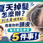 夏天掉髮與頭皮養護衛教圖。右側展示放大鏡檢視頭皮與髮縫特寫，左下為困擾摸頭的男子插畫。畫面印有夏天掉髮怎麼辦？別急著怪年紀，而是你的頭皮每天都在承受5件事等頭皮護理衛教文案。