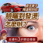 夏季曬傷急救衛教圖。右側為臉部曬紅曬傷的女性特寫，左側展示溫度計與紅色汽車，左下角為女醫師插畫。畫面印有臉曬到發燙怎麼辦、皮膚科3步驟這樣做等曬後修護文案。